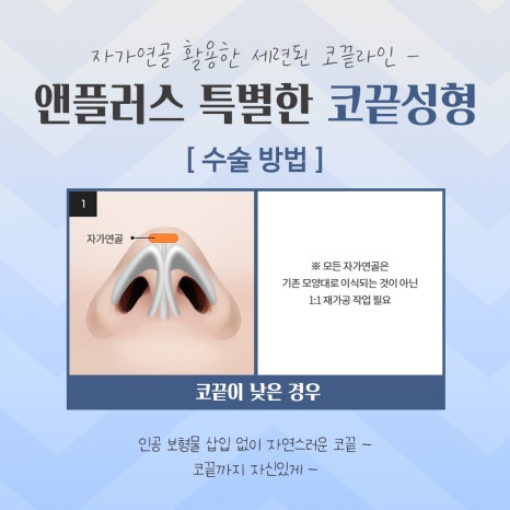 Looking into Comparisons of Tip Rhinoplasty Reviews image 7