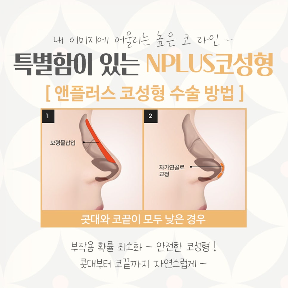 If You’re Looking for a Place That Does Rhinoplasty Well! image 7