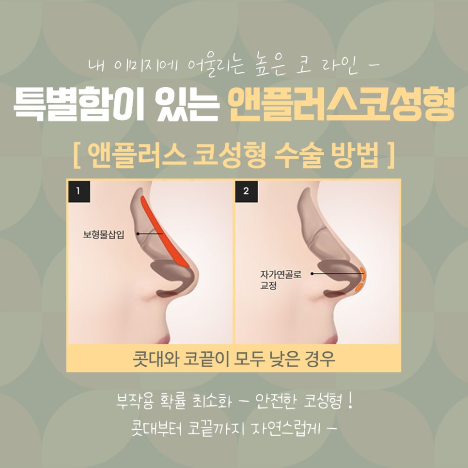 직반버선코 라인으로 교정된 코수술후기 관련 이미지 10