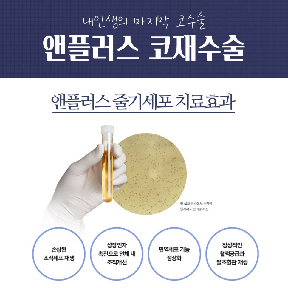 Complete Guide to Revision Rhinoplasty Recovery Period and Surgical Methods image 4