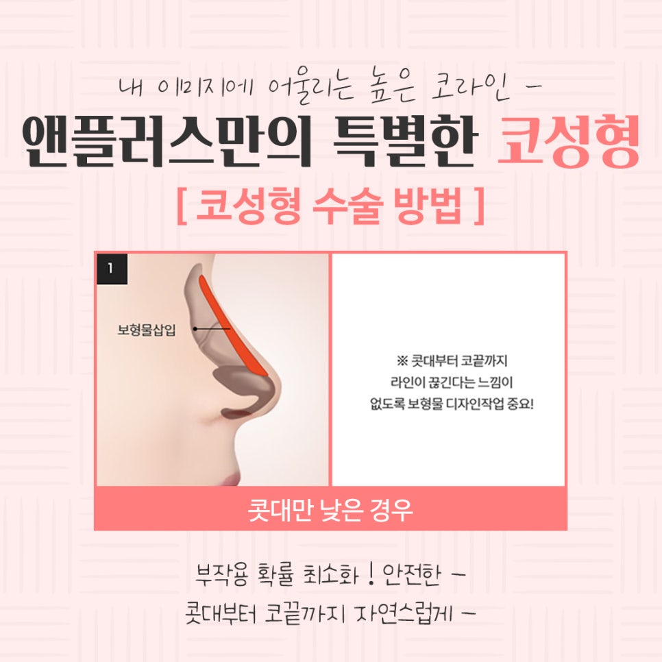 Checking Nose Surgery Reviews image 10