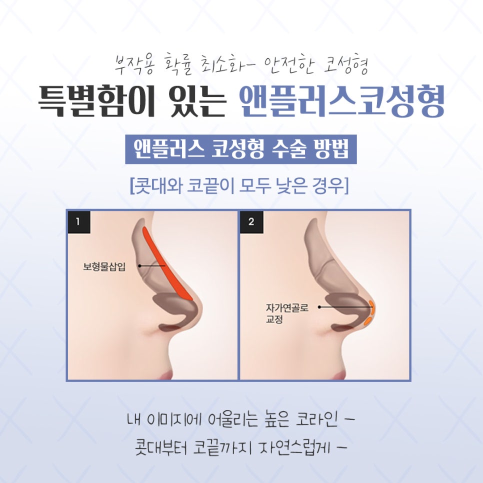 코성형전후 개선할 점을 확인하고 관련 이미지 8