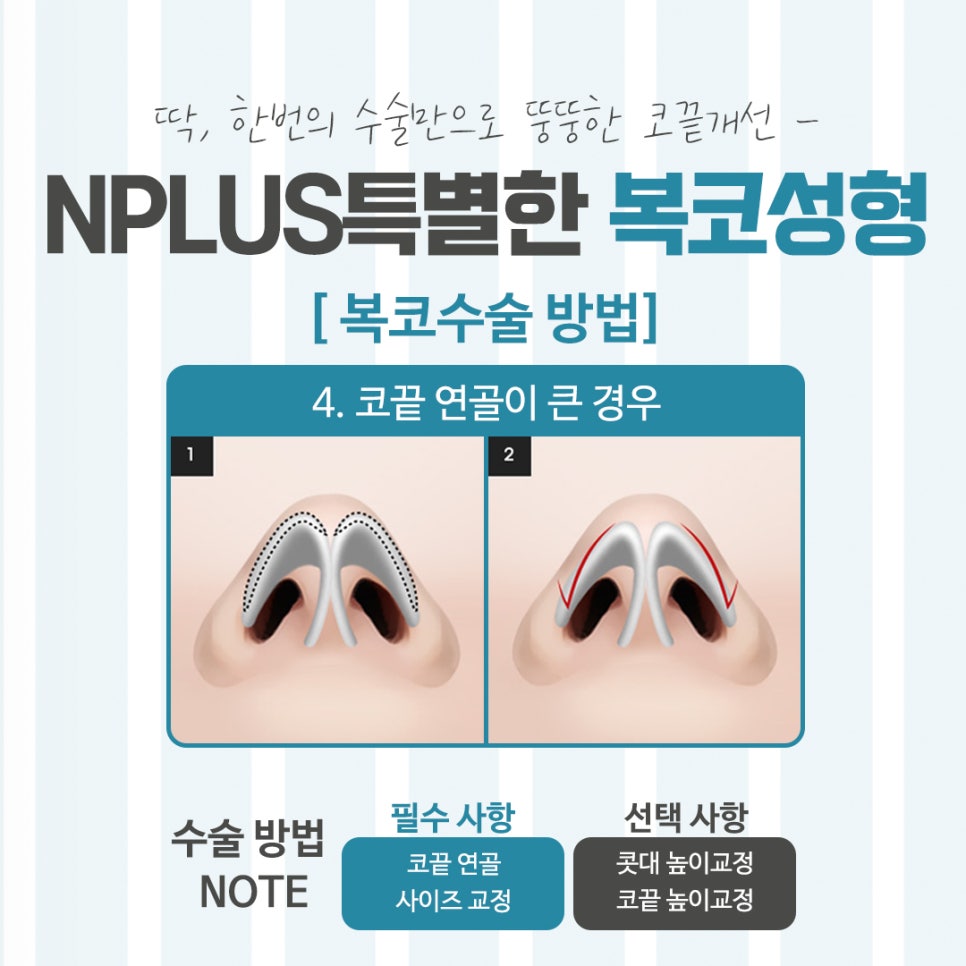 Looking Closely at Bulbous Nose Surgery Reviews image 11