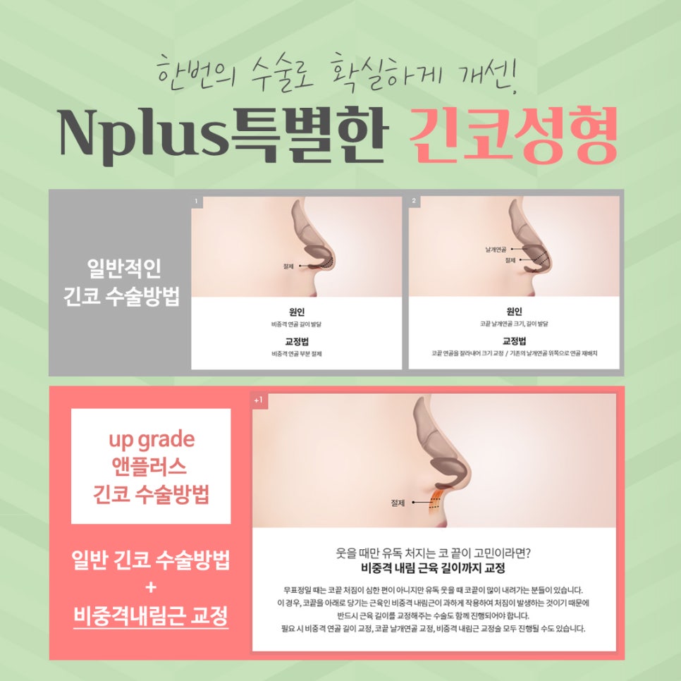 Long Nose Surgery: From Looking Older to Looking Younger image 6