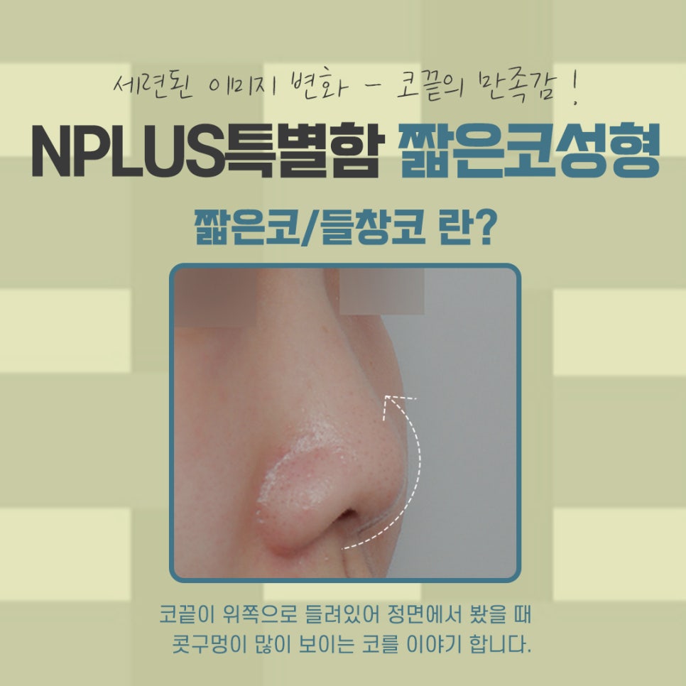 짧은코성형을 통한 자신감 회복 관련 이미지 4