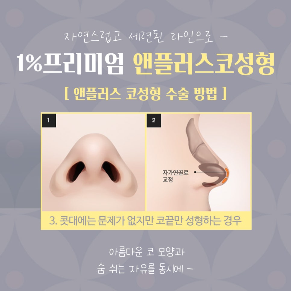 자가늑코수술 정확한 진단으로 관련 이미지 10