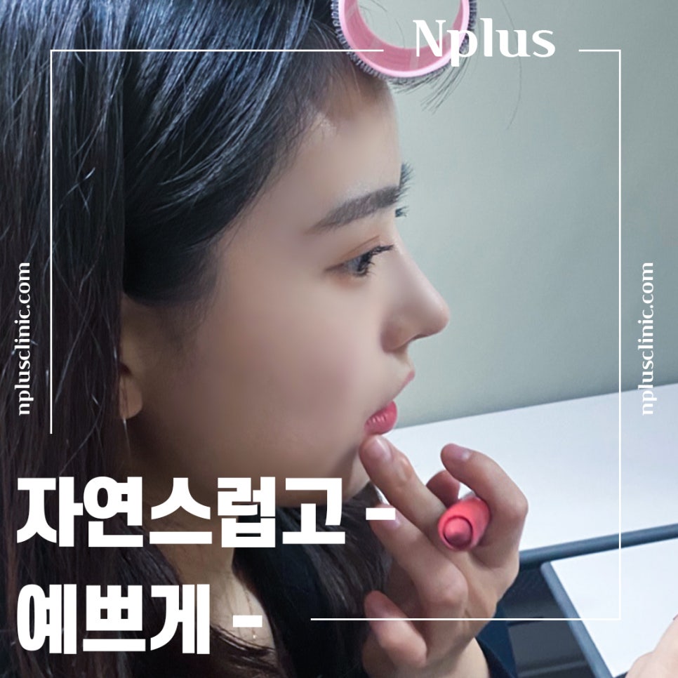 코성형후기 자연스럽고 예쁘게 관련 이미지 3