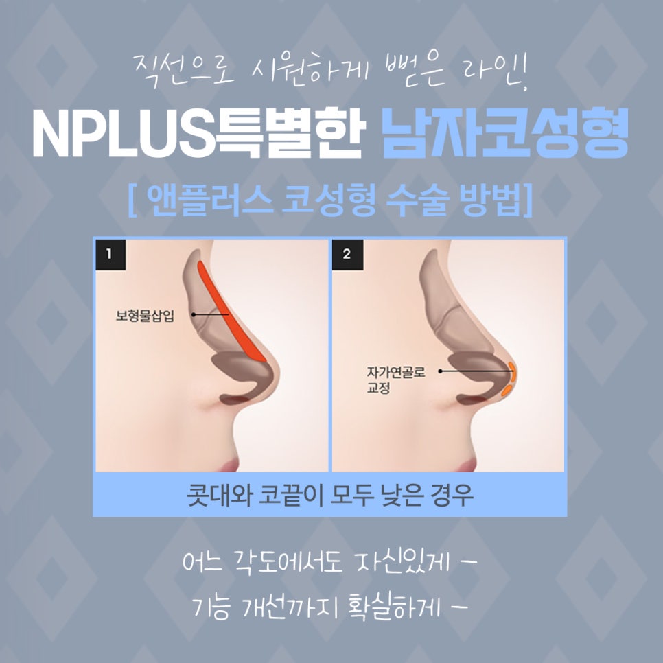 Male Nose Surgery Review: You Should Also Look into Function image 8