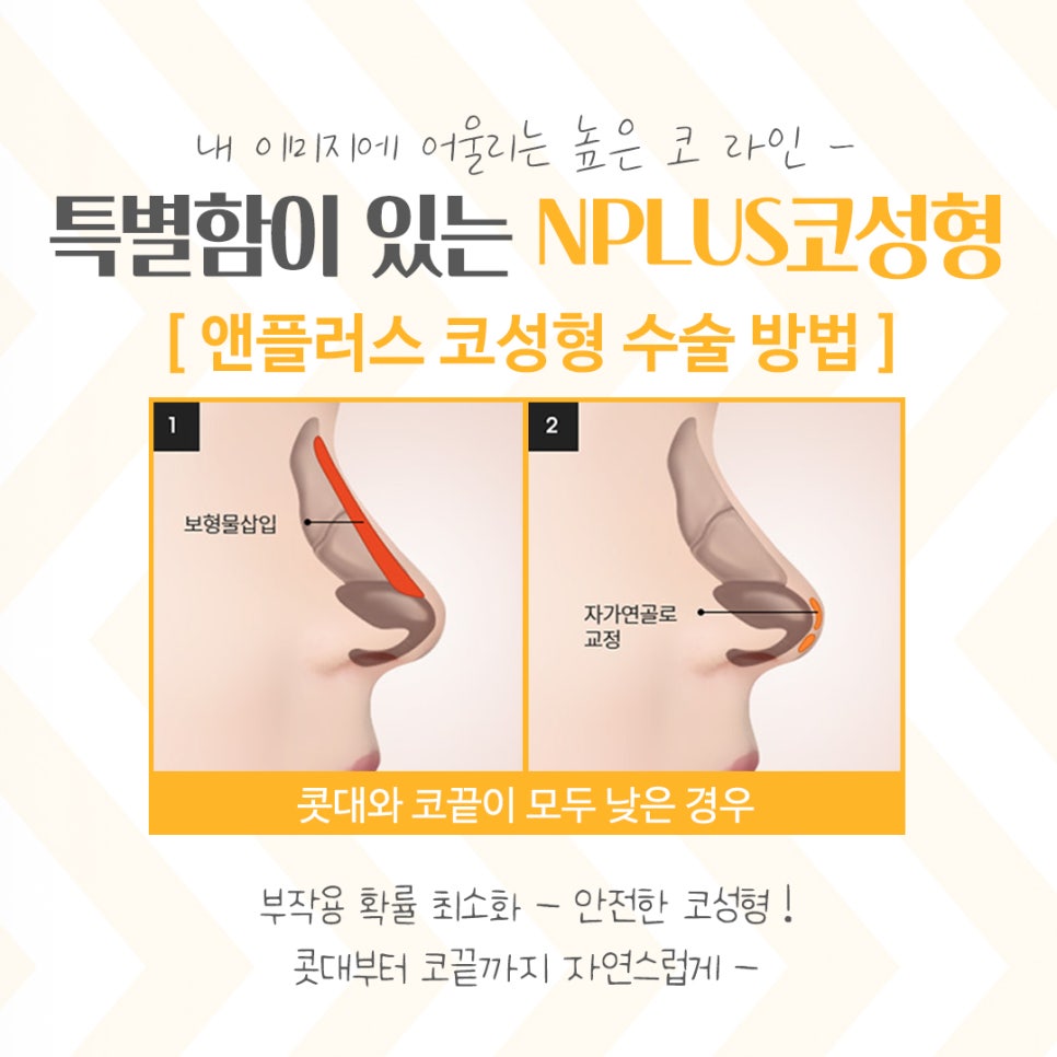 코성형잘하는곳에서 세련된 라인으로 관련 이미지 8