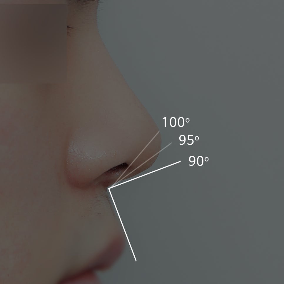 What Is the Prettiest Nose That Suits My Face Best? image 4