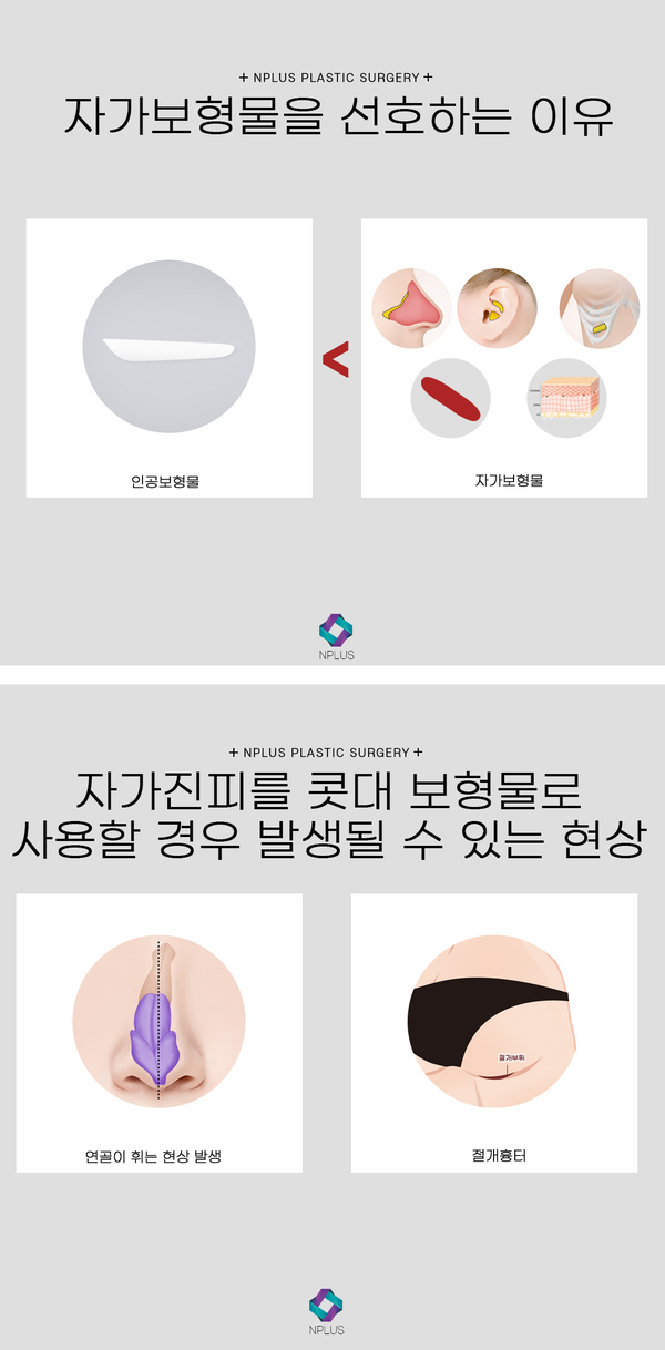 무보형물 코수술 자연스러운 코끝성형 관련 이미지 6