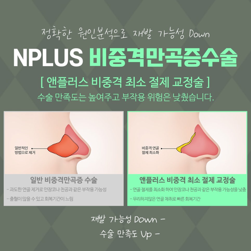 비중격코수술 원인 파악을 확실하게 관련 이미지 10