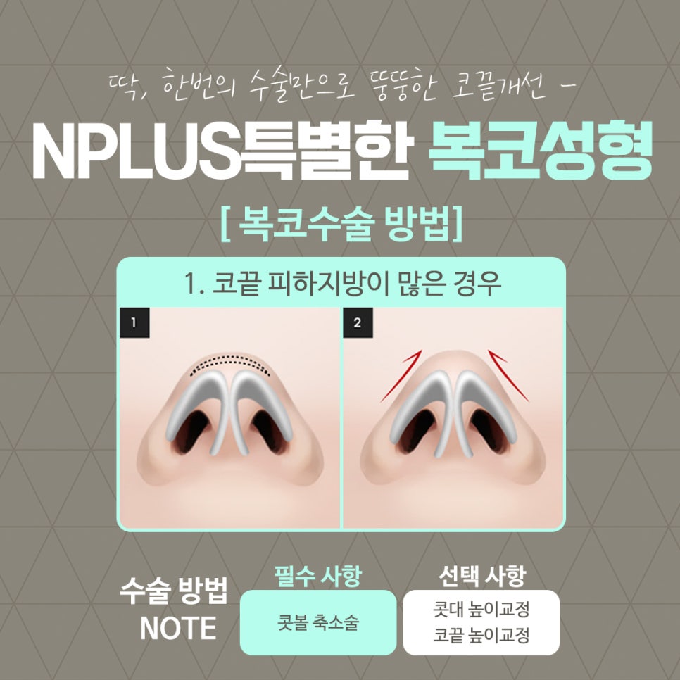 복코수술후기를  확인하고 세련된 이미지로 관련 이미지 9