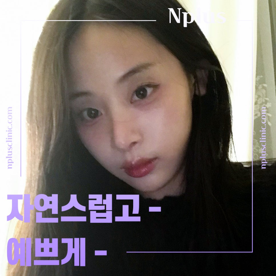 기능코성형후기에 대한 체크리스트 관련 이미지 6