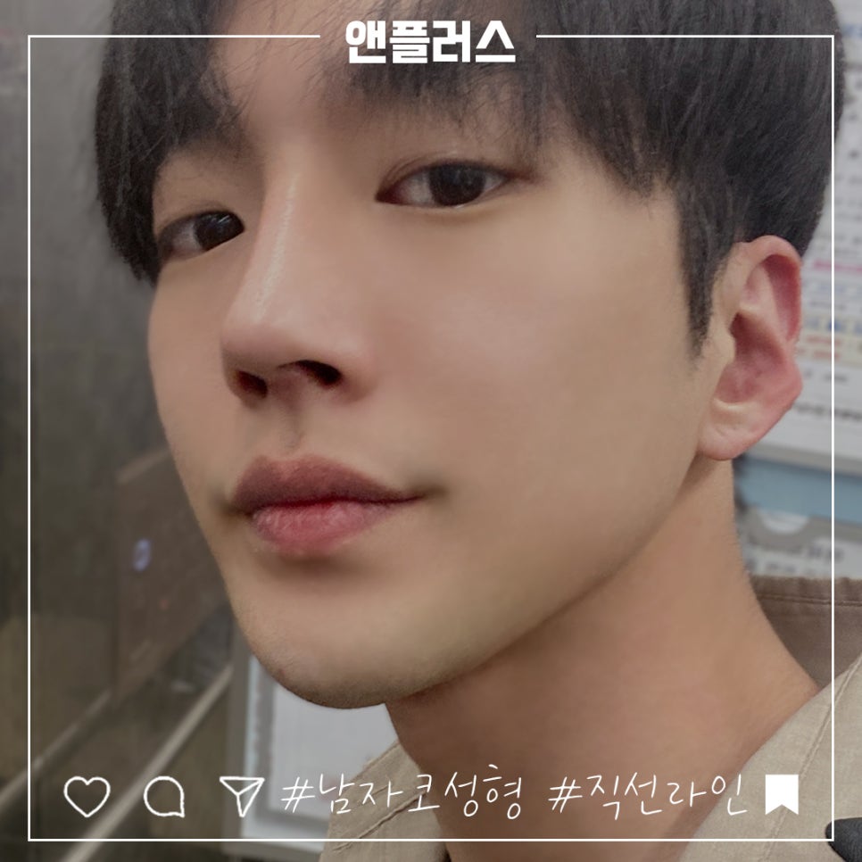 남자코성형 직선라인으로 남자답게 관련 이미지 1