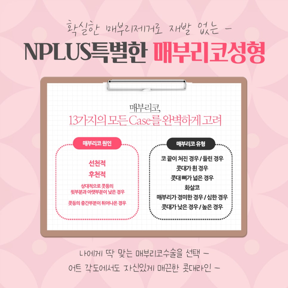 매부리코성형후기 내부까지 확인하고 관련 이미지 5