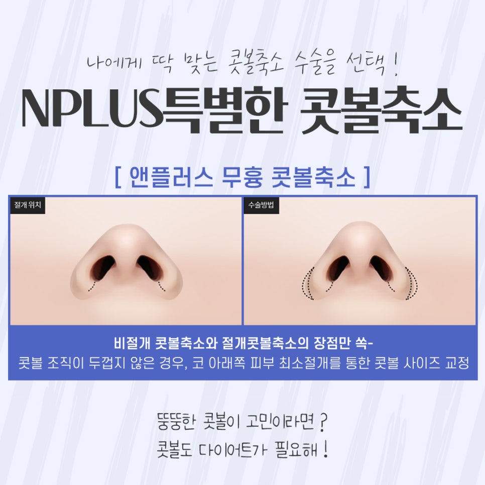 The Importance of Choosing a Nostril Reduction Review image 7