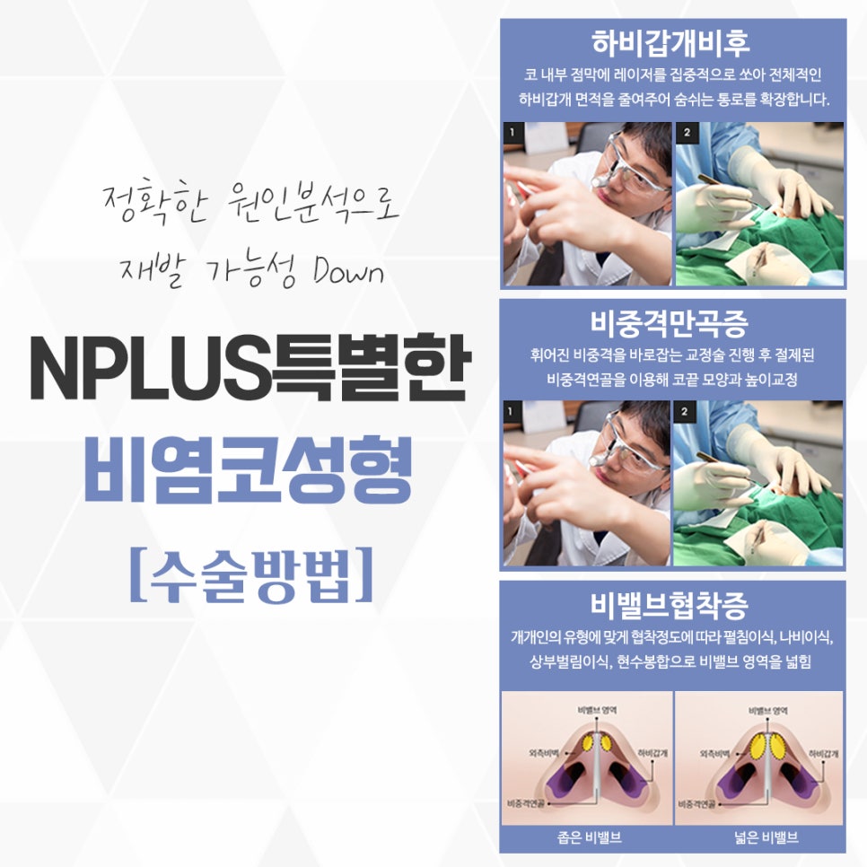Nasal Surgery and Rhinoplasty: Identifying the Exact Cause image 9