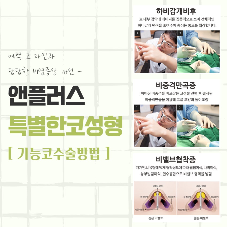 강남코성형에 대해 자세하게 알아보고 관련 이미지 10