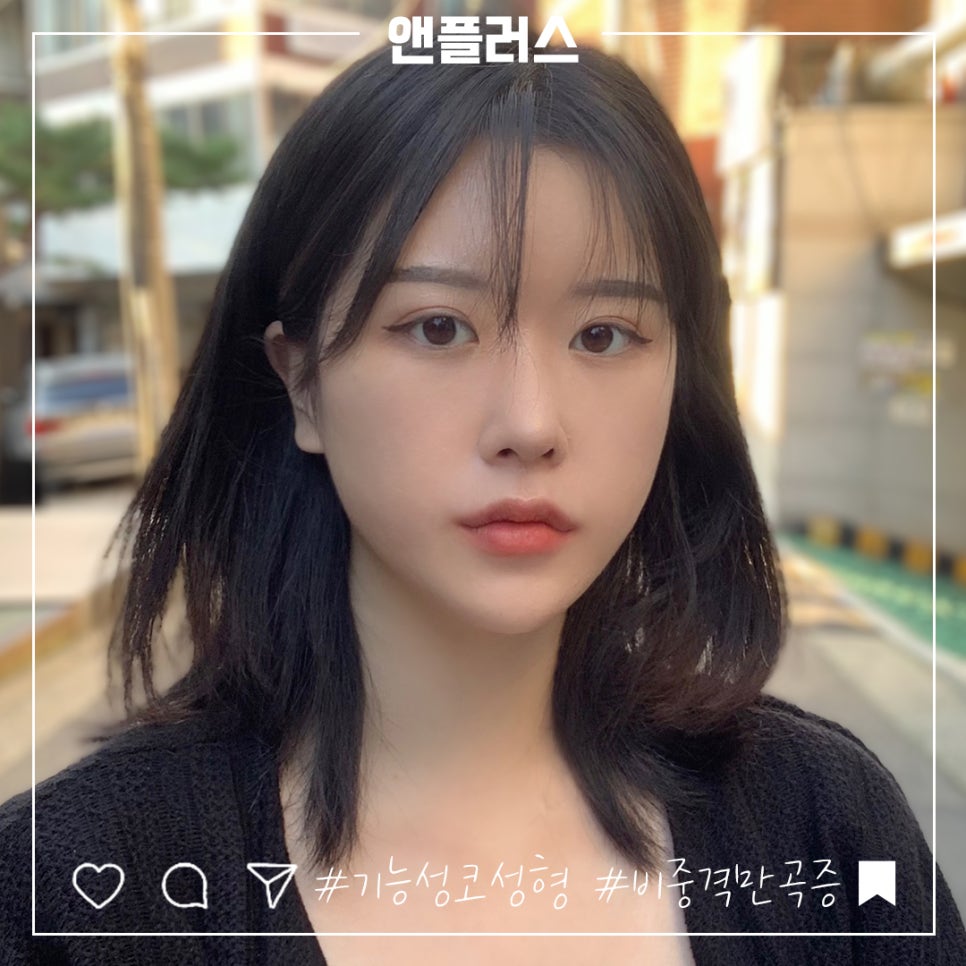 비중격만곡증수술후기 코 내부를 정확하게 파악해야 관련 이미지 2