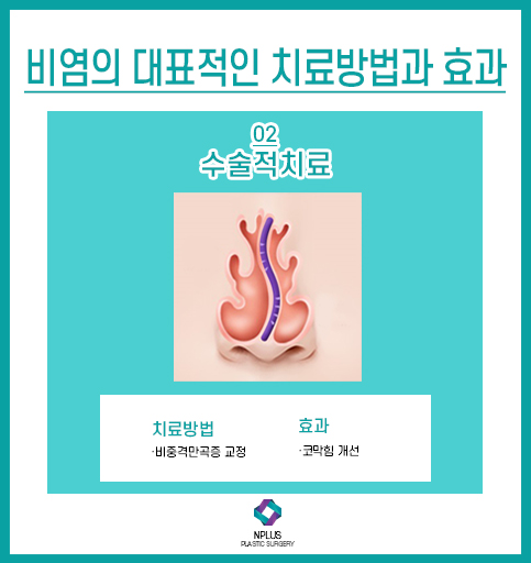 For Septoplasty Surgery, Experience Matters at the Hospital image 2