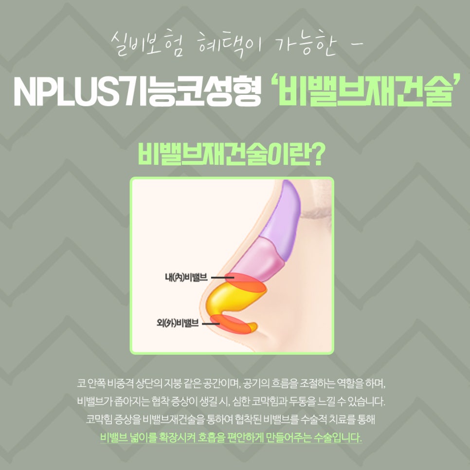 비밸브재건술을 통한 숨 쉬는 자유 관련 이미지 5