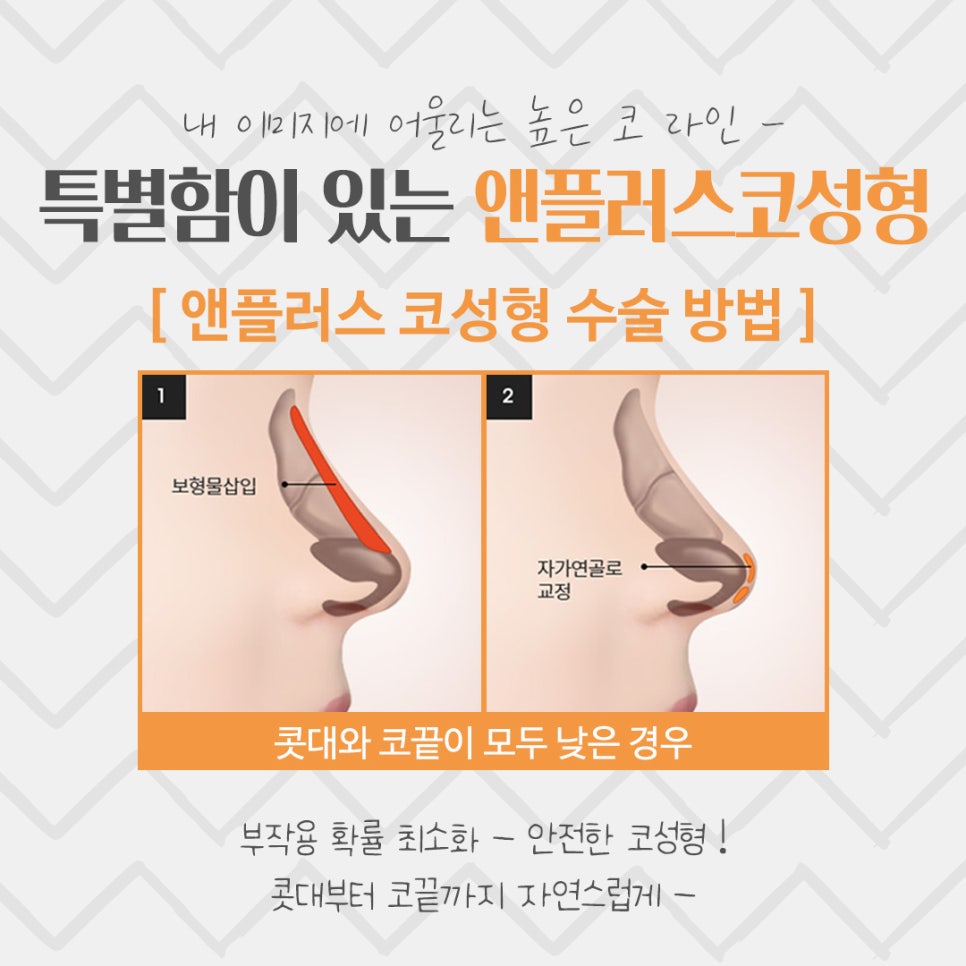 코성형후기 예쁘고 자연스러운 라인으로 관련 이미지 7