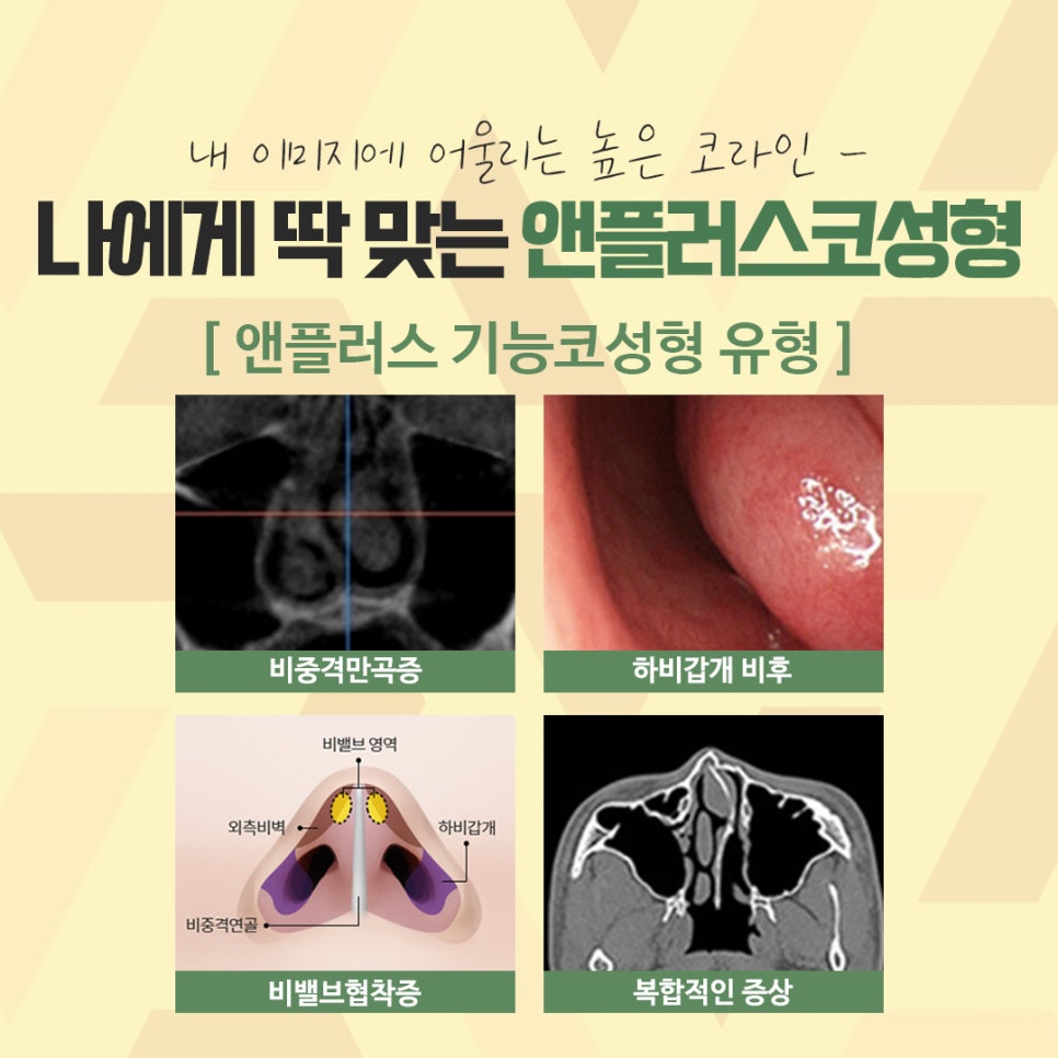 Nose Surgery Review Using Autologous Cartilage image 5