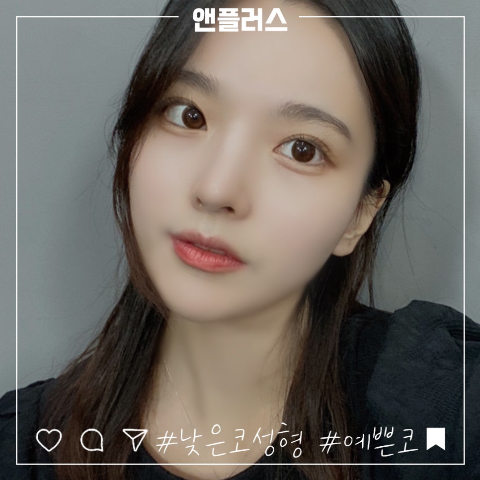 Increased Confidence with Low Nose Surgery image 1