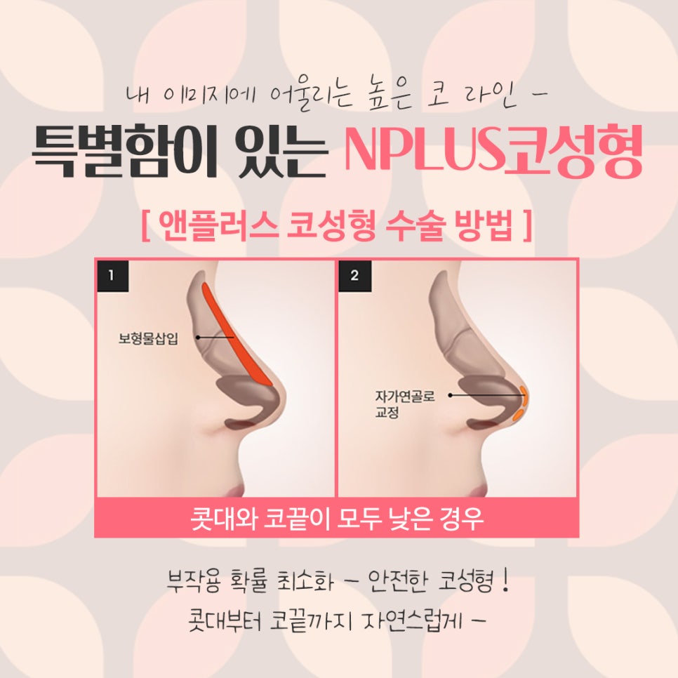 여자코수술후기 정확한 진단으로 관련 이미지 8