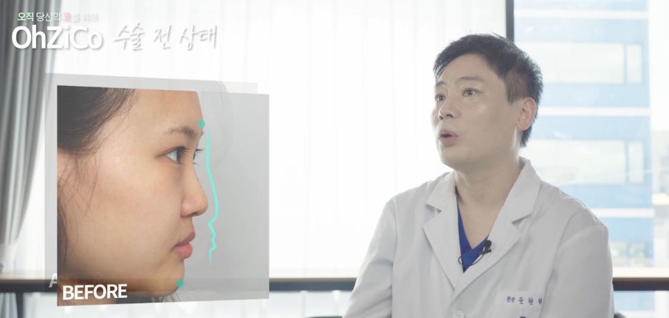짧은코수술 후기까지 자세하게 알아보고 관련 이미지 12
