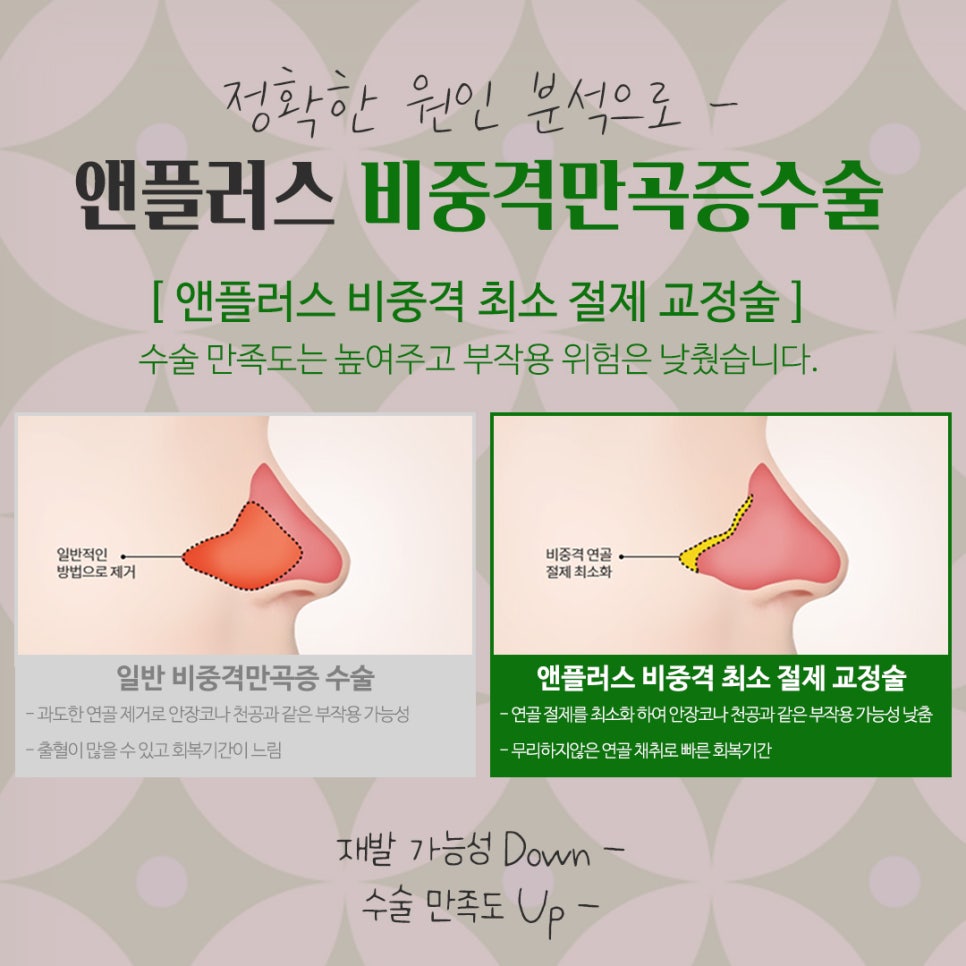 비중격만곡증 수술방법 확인하여 관련 이미지 10