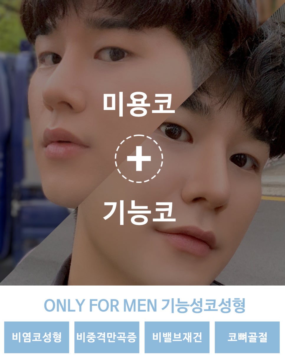 남자코성형후기 기능까지 추가하여 관련 이미지 4