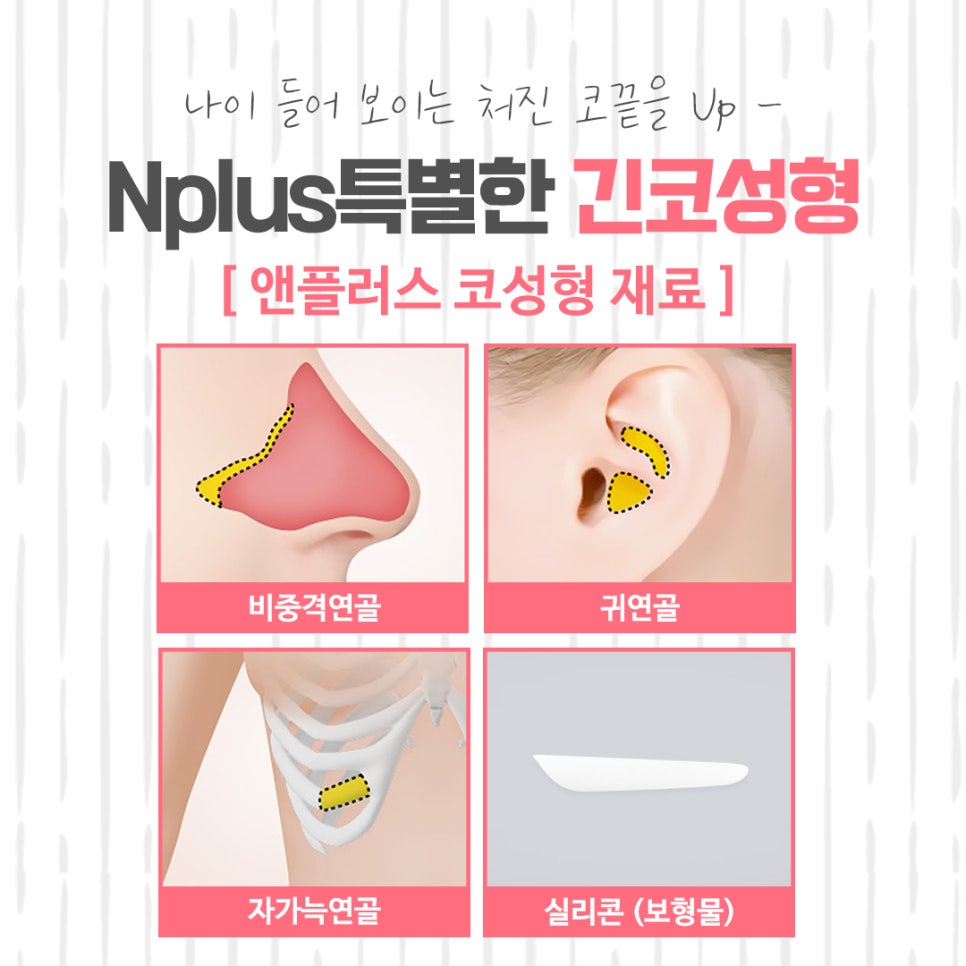 긴코성형 후기까지 알아보고 관련 이미지 11