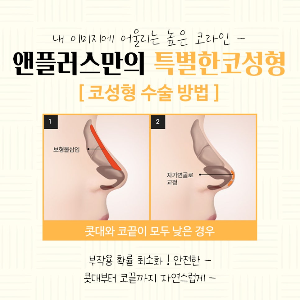 Autologous Cartilage Rhinoplasty for a Natural Nose Line image 7