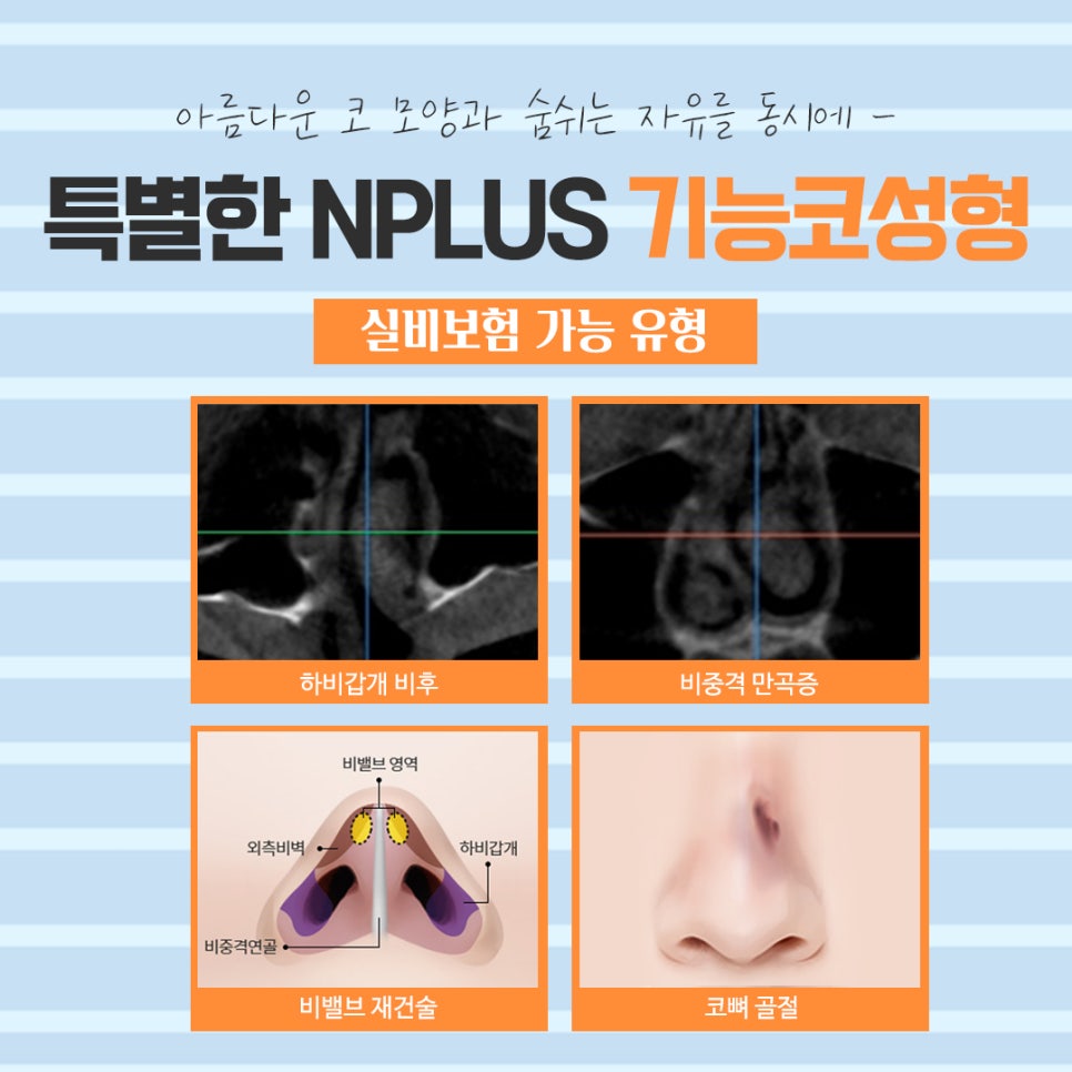 기능코수술실비 확실하게 알아보고 관련 이미지 6