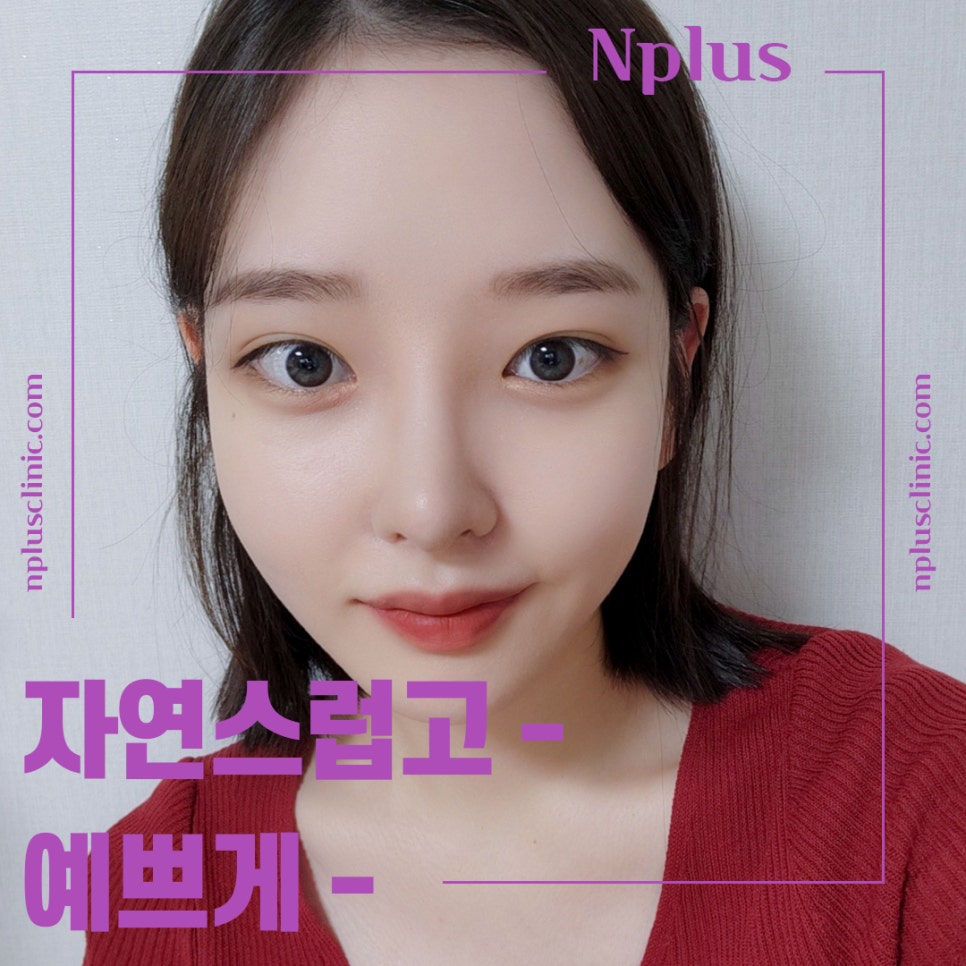 복코수술후기에 대해 세세하게 알아보고 관련 이미지 3