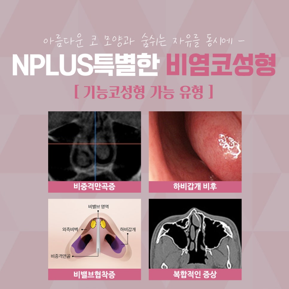 Nasal Surgery Review: Make Sure You Understand It Clearly image 5