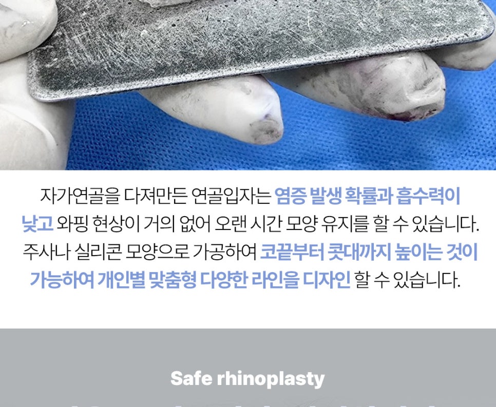 ❤️앤플러스 수험생 코성형 이벤트❤️ 관련 이미지 10