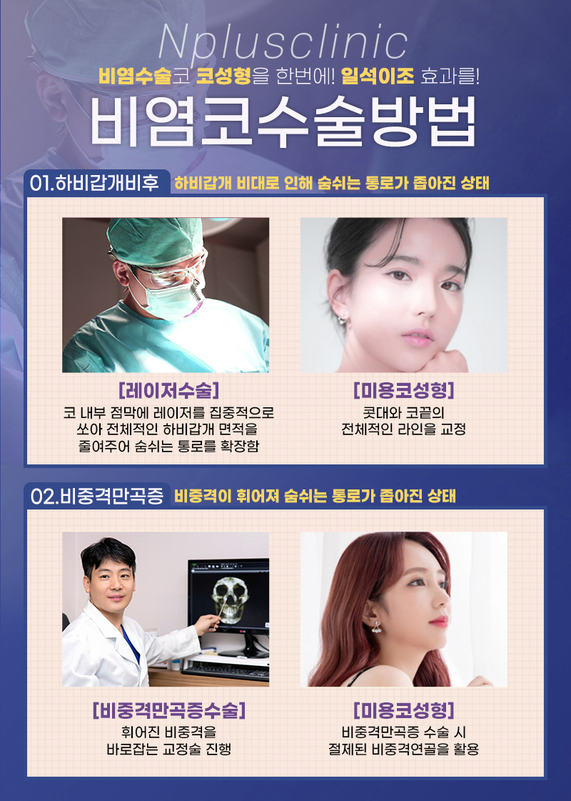 앤플러스에서 진행된 비염수술코성형에 대하여 관련 이미지 6
