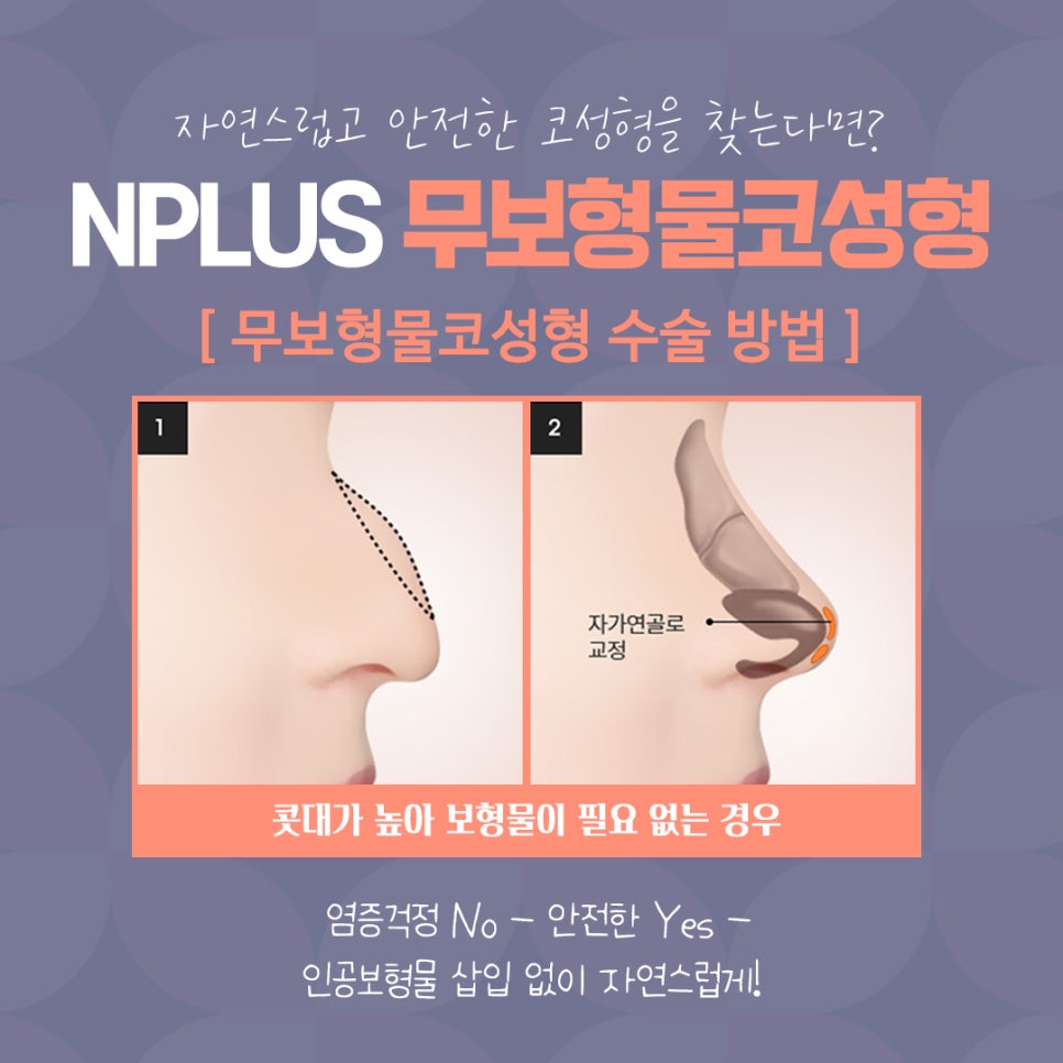 무보형물코수술 자연스러운 코 라인을 원한다면! 관련 이미지 8