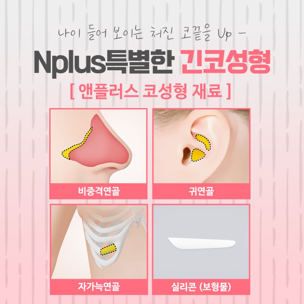 긴코성형 자연스럽게 교정하여 관련 이미지 10
