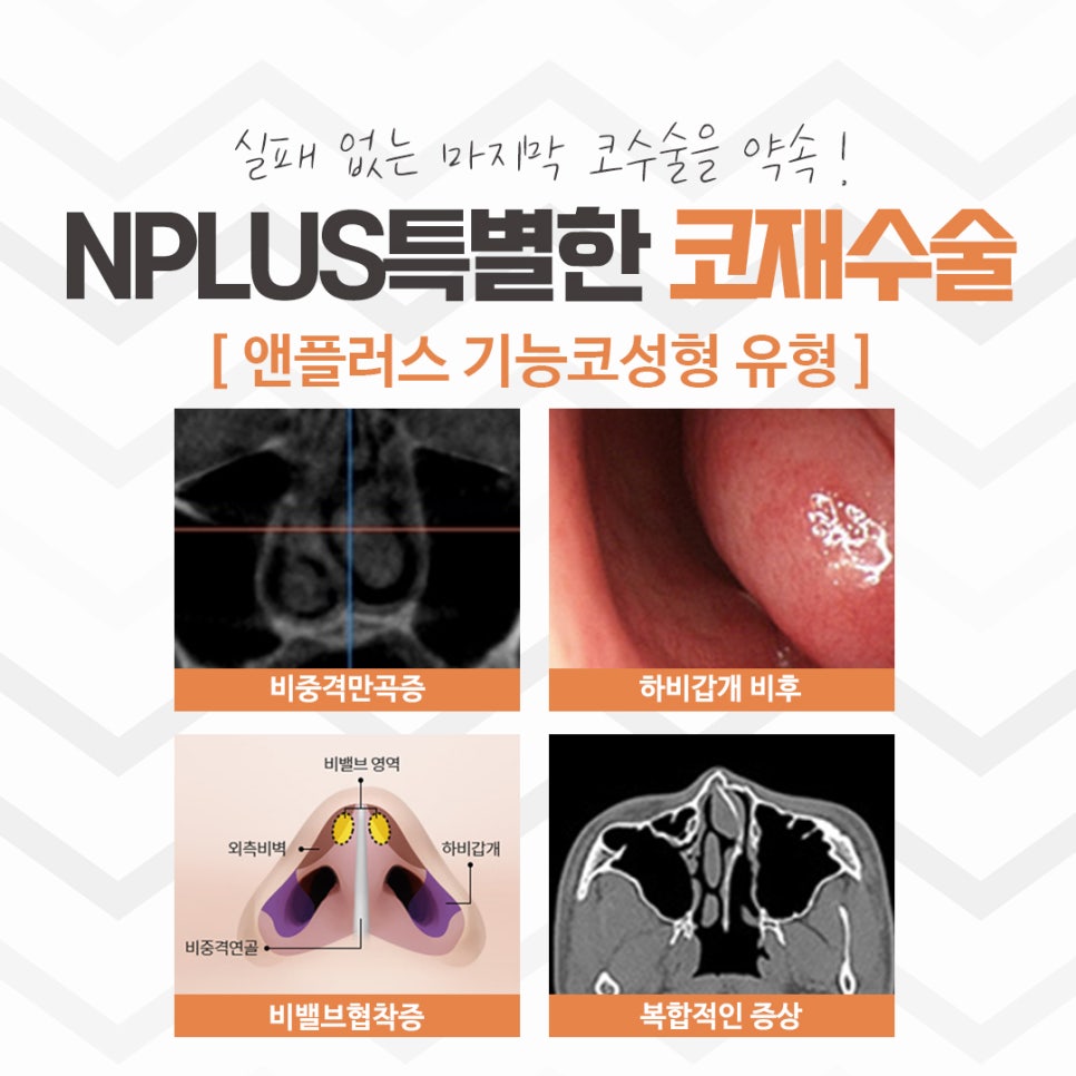 The Importance of Choosing a Revision Rhinoplasty Review image 6