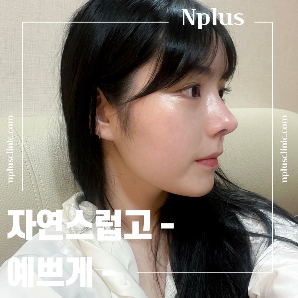 들창코수술에 대해 자세하게 알아보고 관련 이미지 1