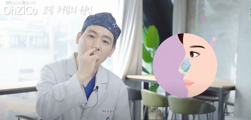 코성형 후 코끝처짐 원인과 해결 방법 관련 이미지 4
