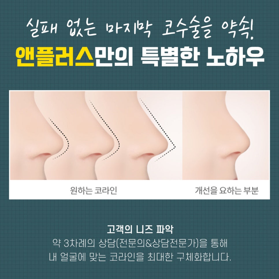 Revision Rhinoplasty Review: A Choice You Won’t Regret image 3