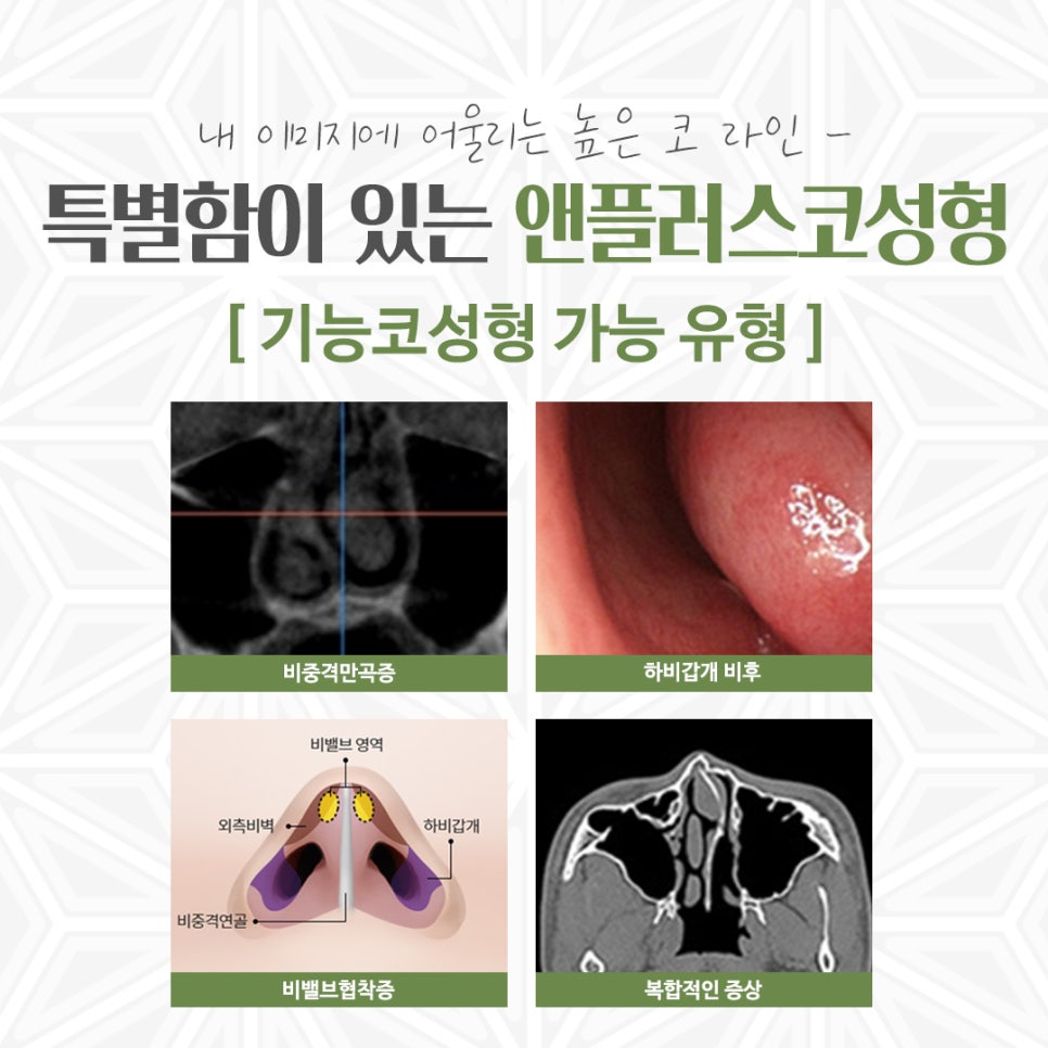 Make Sure to Review Rhinoplasty Costs Carefully Before Deciding image 5
