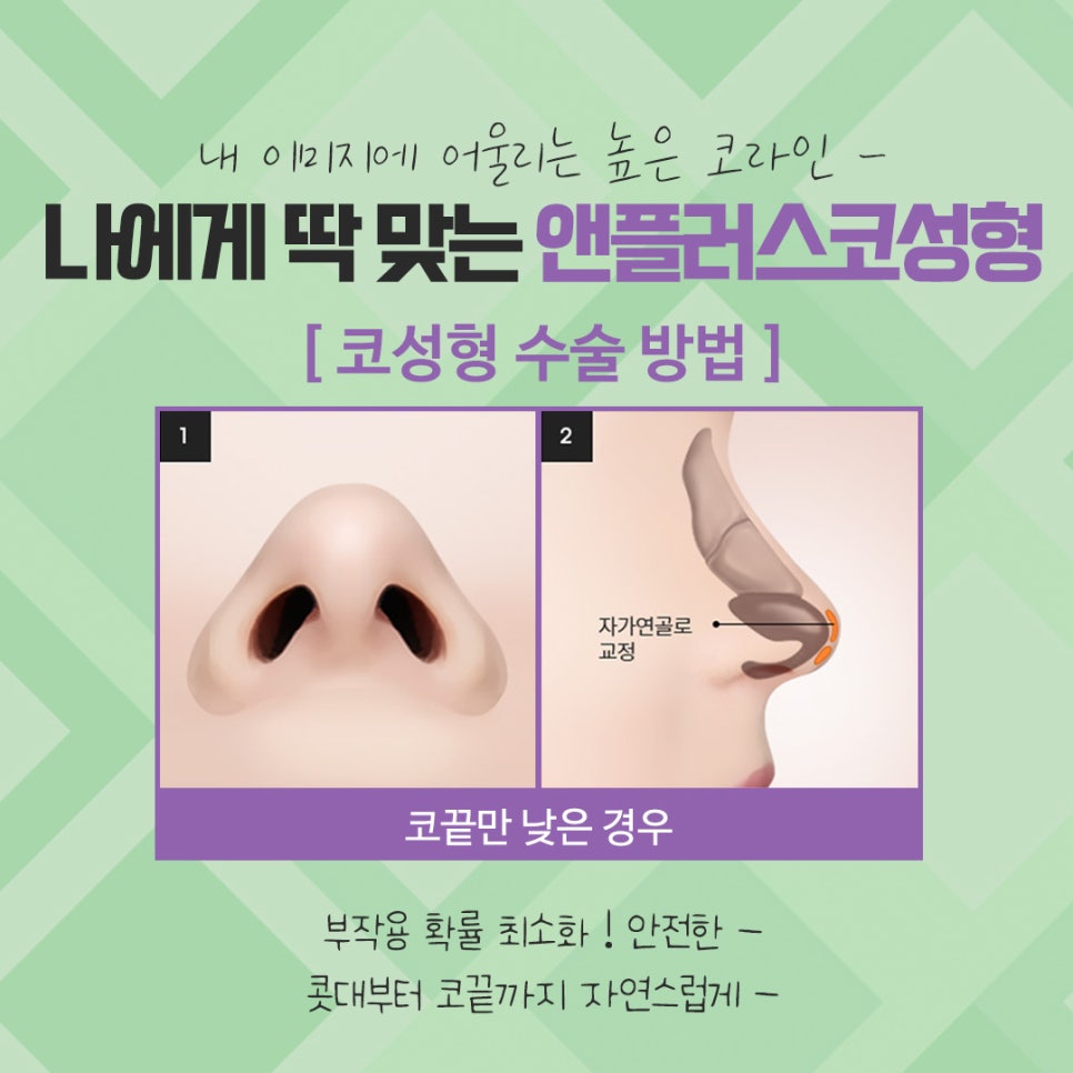 Check the Difference Before and After Rhinoplasty image 8