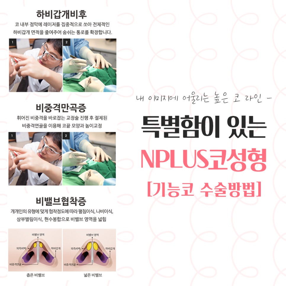 코수술후기 정확한 진단으로 관련 이미지 8