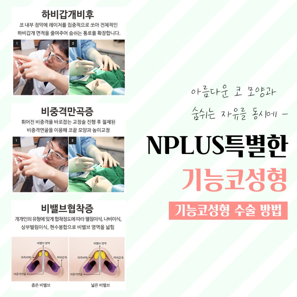 코성형후기 제대로 알아보고 관련 이미지 11